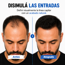 Rellenador Capilar Instantáneo — HairOn