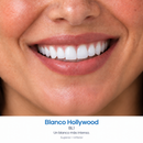 Carillas Dentales Removibles – Sonriva (Superior + Inferior)